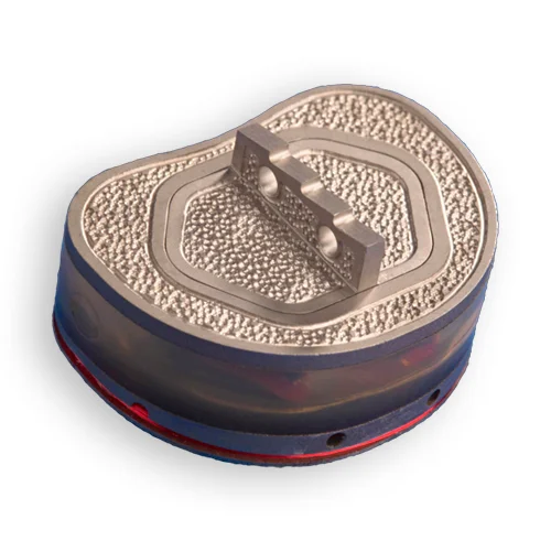 Intervertebral Disc Implant - Image 1